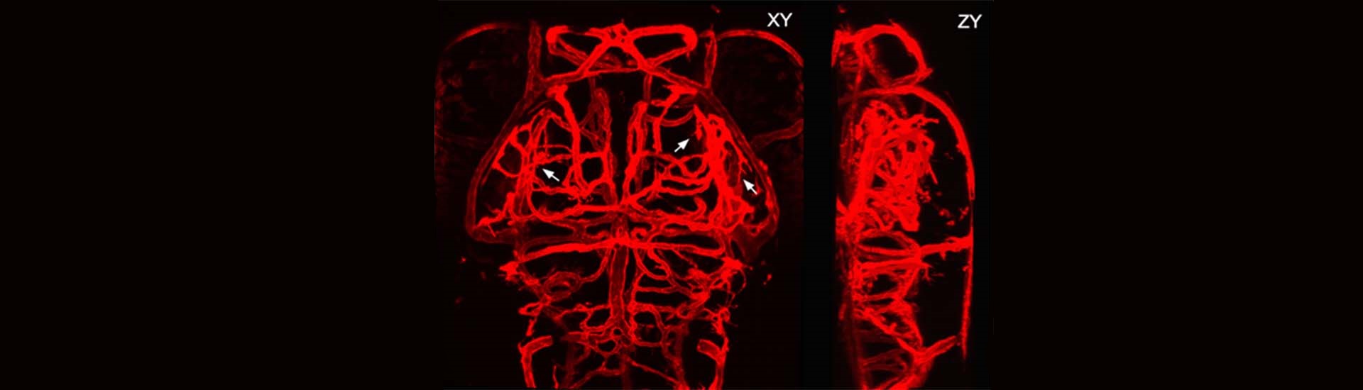 中科院腦科學與智能技術卓越中心（神經科學研究所）杜久林研究組發現大腦三維血管網絡形成的細胞和分子機制
